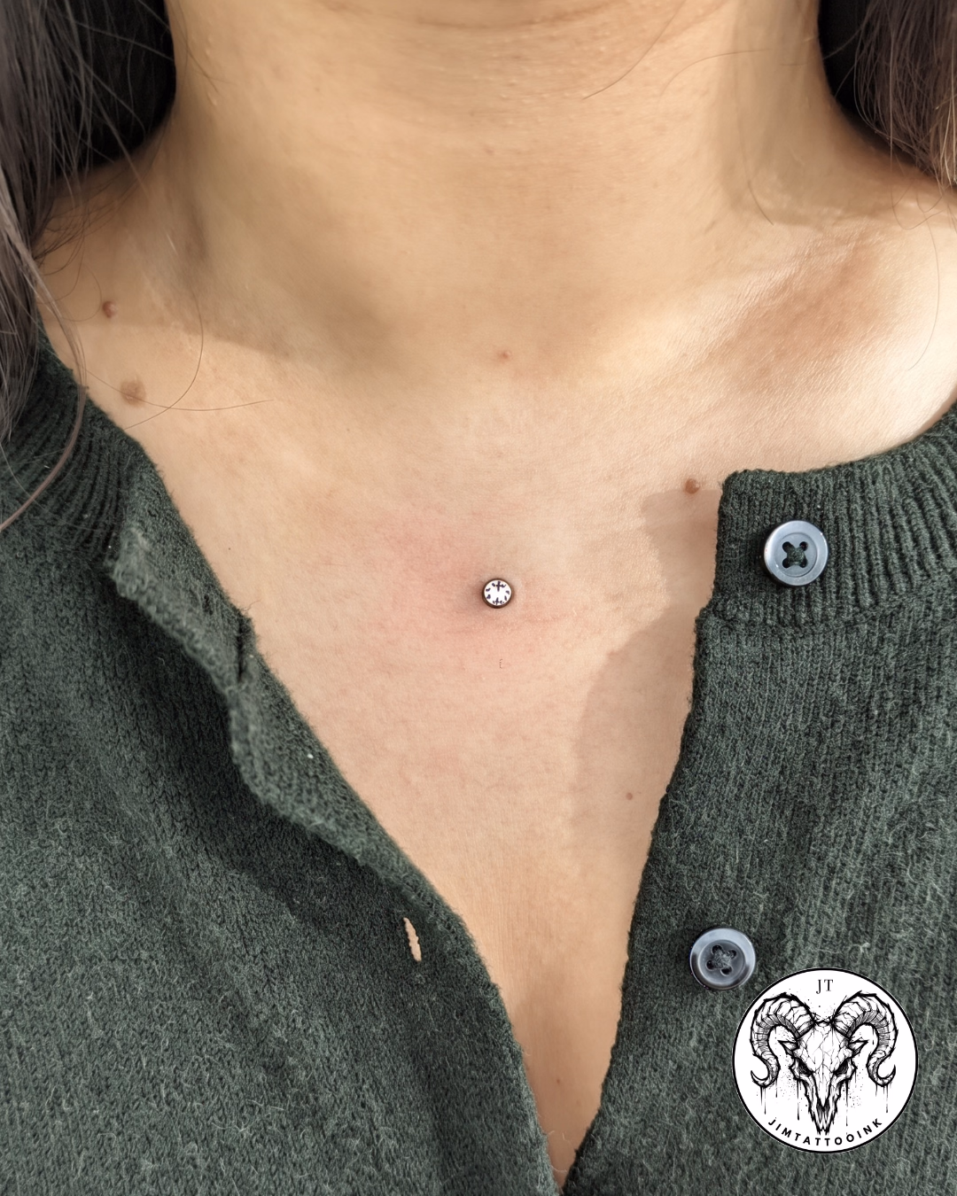 Microdermal en pecho